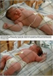 6.2kg 슈퍼 베이비, 키는 63.5cm 초우량아 탄생