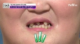 치아 미백의 원리, 비밀은 과산화수소에 있다