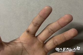 매일 스윙 500번, 굳은살에 새긴 아기사자의 각오 [엑:스토리]