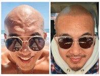 서희원♥ 구준엽, 두피 문신 광고모델?…알고보니 무단 도용 [엑s 이슈]