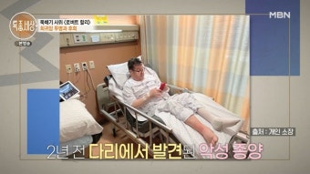 로버트 할리, 마약 논란 후 근황…'0.1%' 희귀암 투병 (특종세상)[종합]