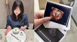 아빠 판박이…박수홍♥ 김다예, 임신 16주차 초음파 사진 공개