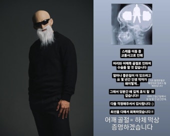 김계란, 교통사고로 머리·어깨 골절…