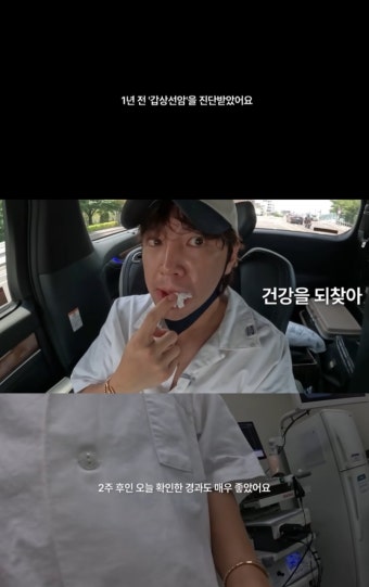 장근석, 갑상선암 투병 후 긍정적 마음가짐 유지 중.