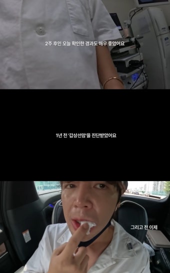 장근석, '갑상선암' 진단→수술 후 회복 단계…