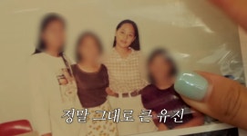 유진, 성형·시술 NO 인증…6학년 때 얼굴이랑 똑같아 (유진VS태영)
