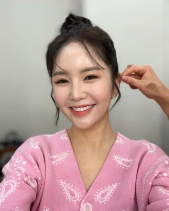 장영란, 쌍수 4번 이유 있었네…확 차오른 미모 