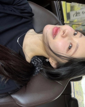 '여성암 극복' 이솔이, 항암치료에 피부 변색…