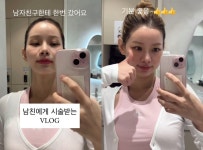 맹승지, '피부과 의사' 남친에 직접 시술받았다…