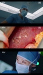 '닥터X' 장승조, 환자 장기에 새겨 놓은 이니셜...섬뜩 [종합]