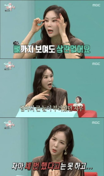 [종합] 장영란, 성형 고백 
