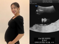 둘째 임신 최희, 초음파 사진 공개 또복이 콧구멍 보고 옴