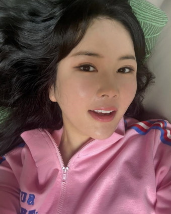 장영란, 쌍수 4번 후 완전히 자리 잡았네…못 멈추는 