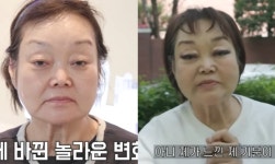 ‘69세’ 이혜정, 실·콜라겐 넣고 쫙 보수하더니…“평생 예쁘단 소리 못 들어봤는데”
