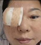 '73세' 양희은, 또 다시 건강 적신호…'난소암·시한부 선고'에 이어 각막이식 수술까지