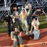 ‘모발이식’ 이채연, 머리 3571모 심은 후…모발에 물뿌려도 문제 없어