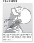 수빈 교통사고, 후유증 제대로 알고 치료해야