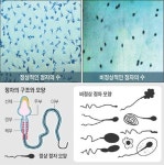6월에서 8월, 임신 가능성 낮은 이유는 정자 때문