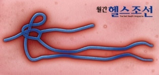 에볼라바이러스의 여러 얼굴들