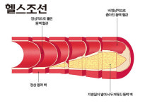 혈관건강, 맥을 짚어라