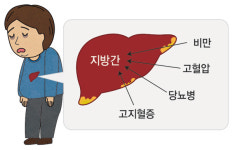 지방간, 술 안 마셨는데 5년 새 115% 증가