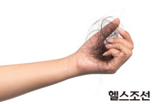 자꾸 빠지는 머리카락, 어떻게 하죠?