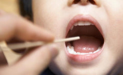 우리 아이, 유치 빼고 새로난 치아가 유독 비뚤어져 있다면?