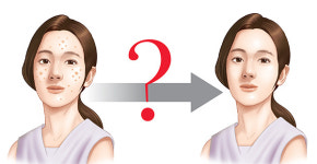 효과 내기 전의 일시적 부작용이라는 ‘명현(瞑眩) 반응’ 믿어도 되나?