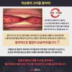 [카드뉴스] 죽음의 이중주 고혈압&고지혈증