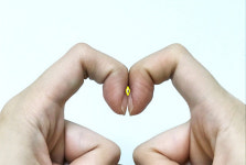 손가락으로 이 모양 안 나오면, 폐암 가능성