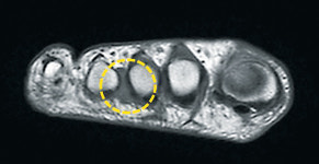 족부 전문의만 5명… 못 보는 질환 없다
