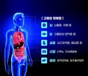 고혈압 가볍게 보다가 혈관 댐 무너지면… 뇌·심장까지 와르르