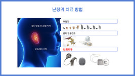 난청이 이명도 유발… 보청기·인공와우로 청각재활해야