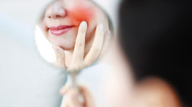 추운 날이면 ‘안면홍조’ 심해지는데… 왜?