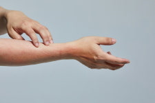 아토피 피부염 있는 여성, 이 때 증상 심해져