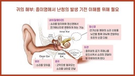 중이염 흔하다고 얕보면 안 돼… 난청 주범될 수도