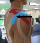 [스포츠의학] 어깨 통증, 간단히 완화하는 테이핑 방법은?