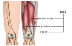 [스포츠의학] 흔한 햄스트링 부상, ‘이것’만 해도 예방