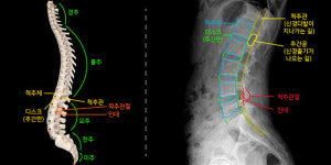 척추의 운명 [무릎의 운명 / 어깨의 운명 / 허리의 운명 / 손발의 운명]