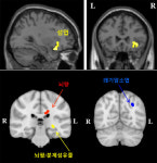 행복감 증진시키는 뇌 부위 밝혀졌다