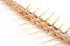 생선가시 걸렸을 때 밥 삼키면 안 되는 이유