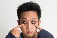 거뭇거뭇 다크서클 싫다면? 이 영양소 보충해야