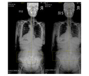 잘 걷는게 이렇게 행복한 일인지 몰랐어요 [ 만성통증을 해결은 척추와 골반의 정렬 해결이 먼저입니다.]