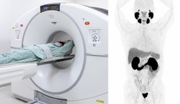 전립선암 3차원 영상으로 진단… 이대서울병원, ‘PSMA PET/CT’ 검사 도입