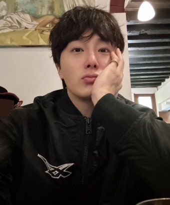 정일우, “뇌동맥류 투병 후 큰 전환점 맞아”… 어떤 질환이길래?