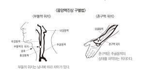 고려수지침학회 손 끝에 있는 태성혈 자리에서 채혈하세요