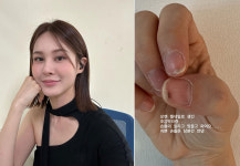 가수 아이비, ‘이것’ 때문에 손톱 뜯기고 멍들었다 고백