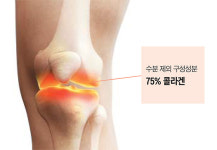 나이 들수록 닳아 없어지는 연골… 콜라겐으로 지켜볼까