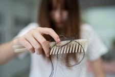 우수수 빠지는 머리카락… 단백질 먹는 것도 도움 되지만, ‘이것’ 안 먹는 게 더 중요