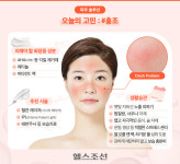 봄볕 받고 빨개진 얼굴… ‘홍조’ 빨리 가라앉히려면?